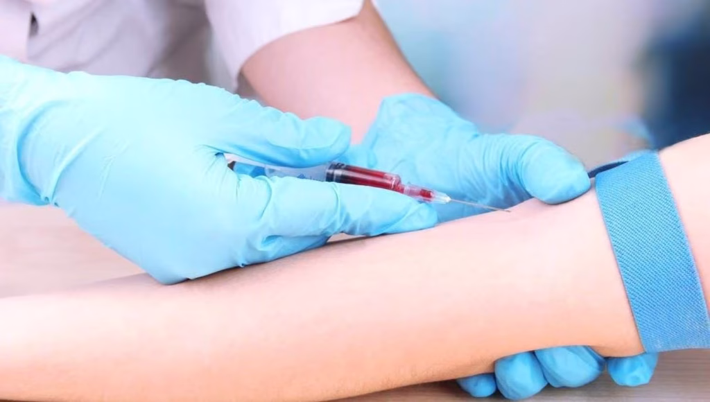 Blood test may predict post surgery recovery time