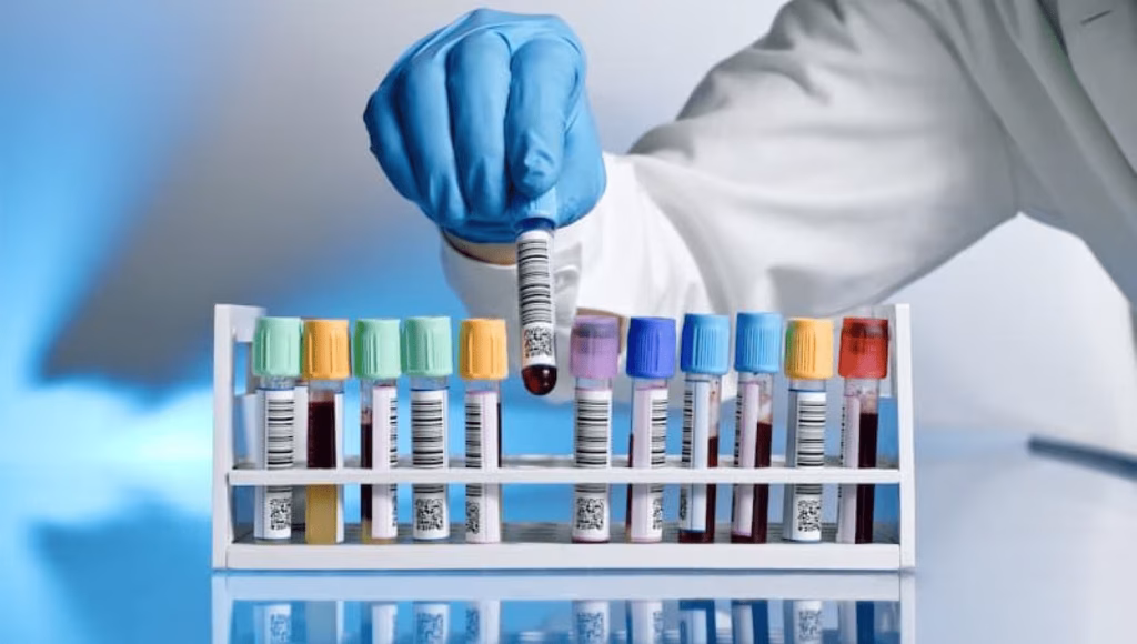 Lab test tubes with barcoding labels