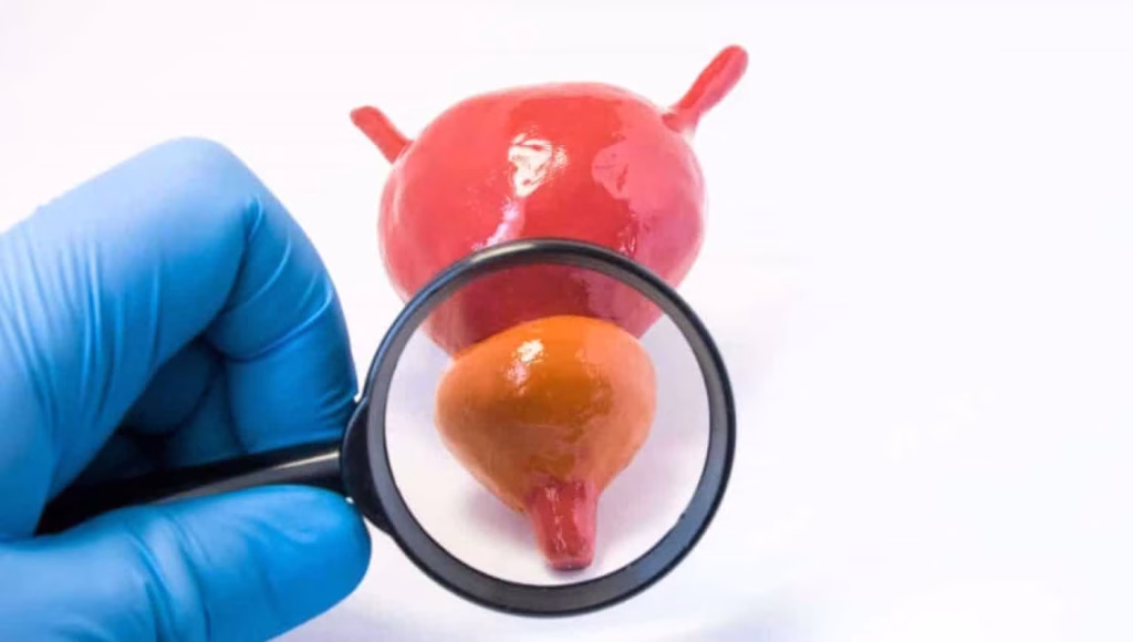 Prostate Health 1 1110x740 1