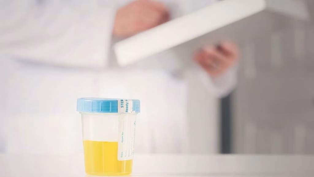 urine 1200x800 1