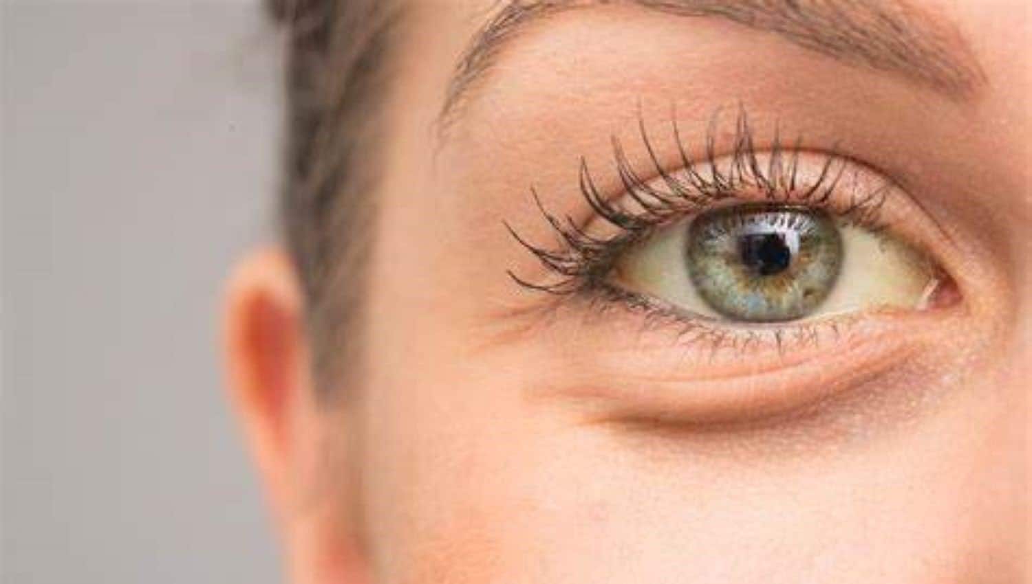 სიყვითლე  | ის, რაც უნდა ვიცოდეთ