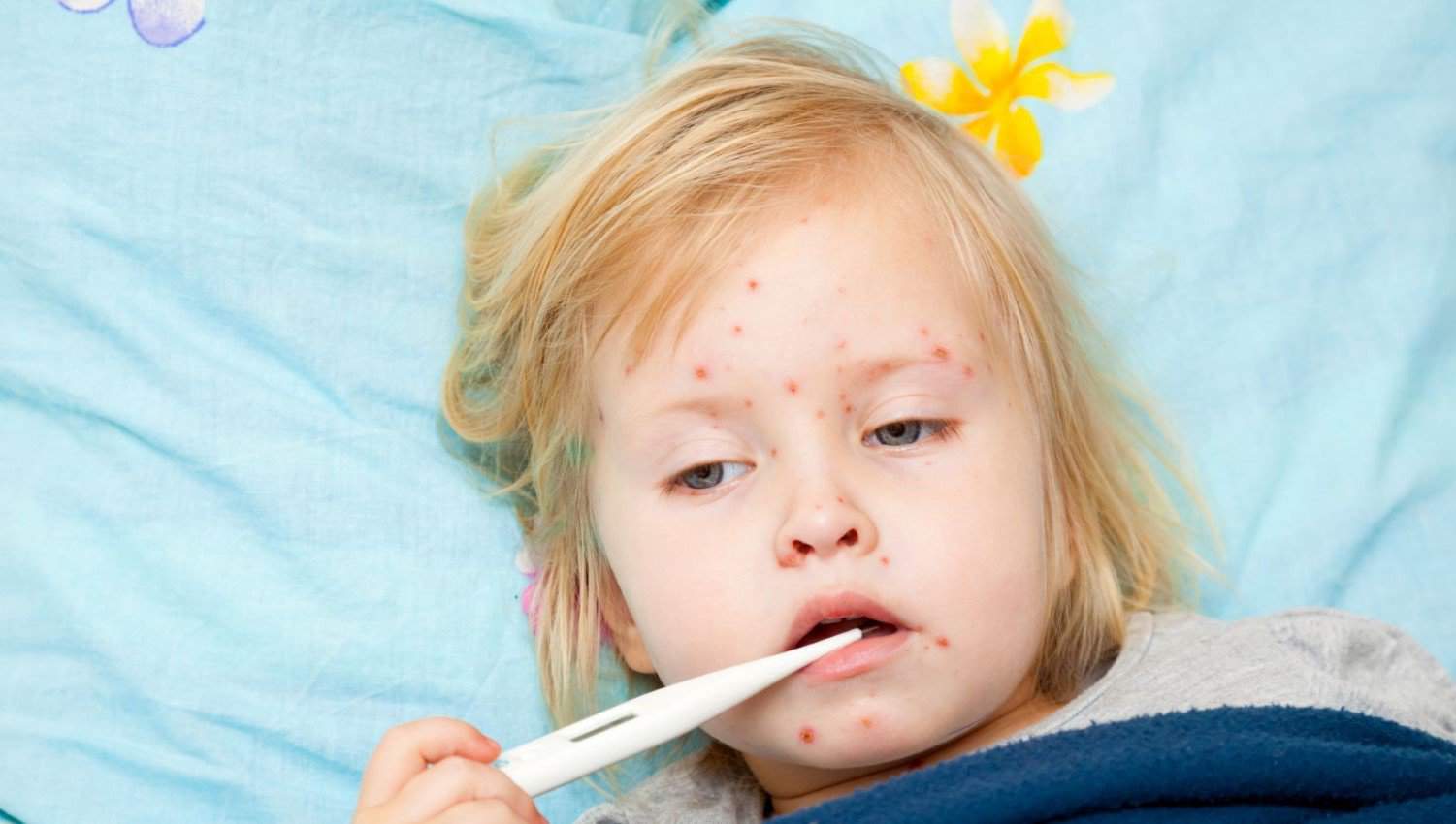 R წითელა  |  ის, რაც უნდა ვიცოდეთ