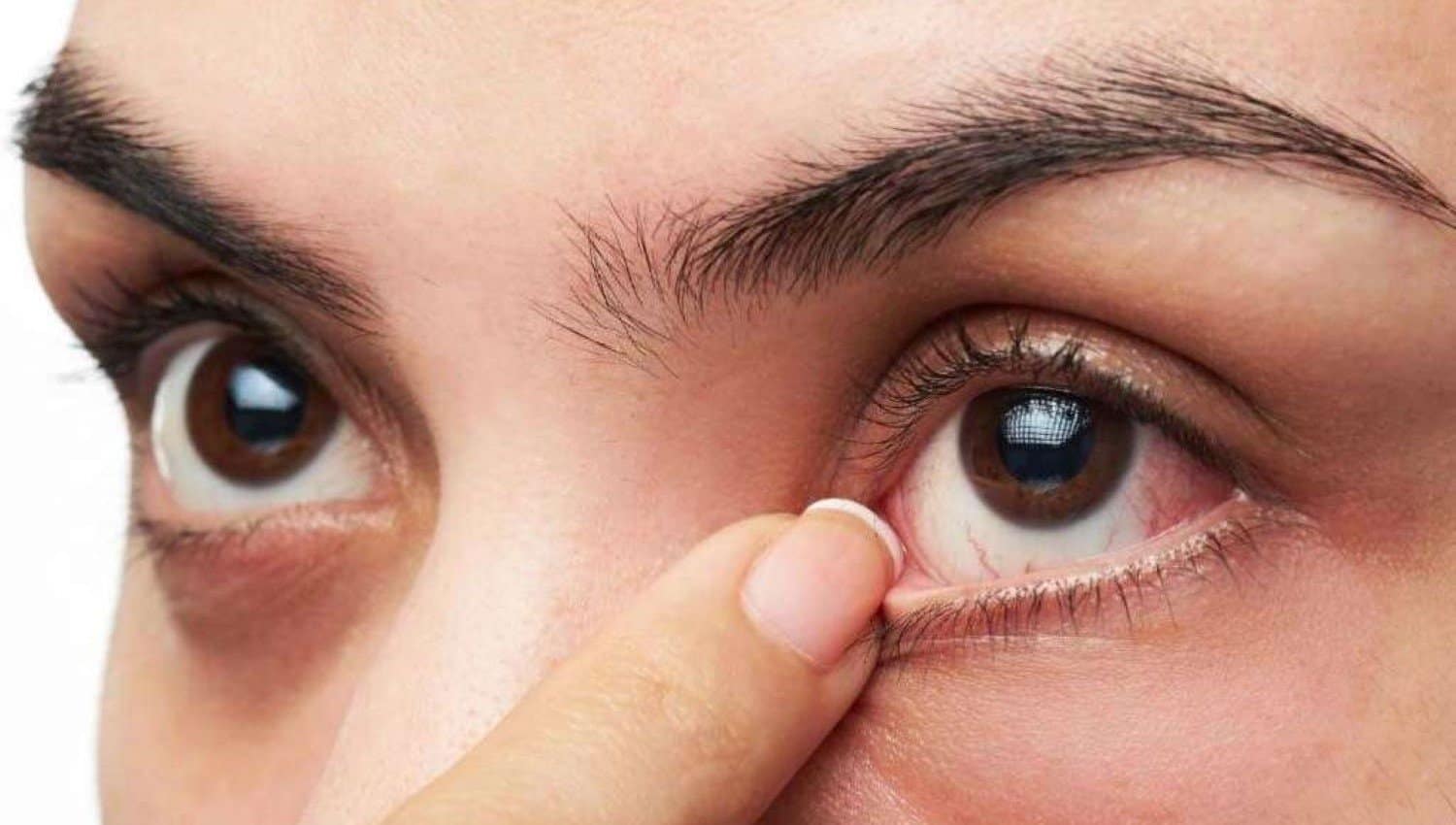 what-is-sjogrens-syndrome-09 შოგრენის სინდრომი | ის, რაც უნდა ვიცოდეთ