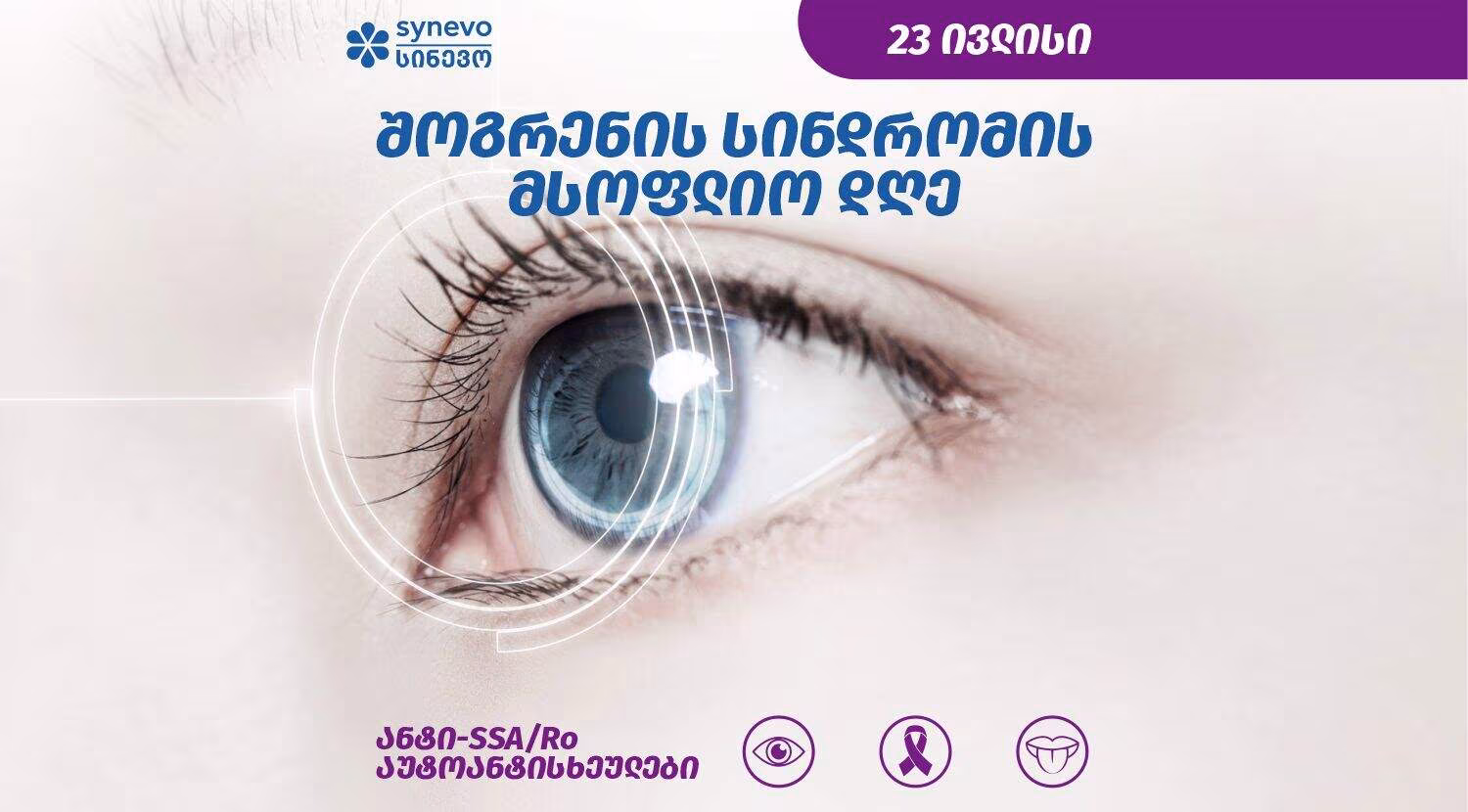 shogren s