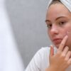აკნე  | ის, რაც უნდა ვიცოდეთ